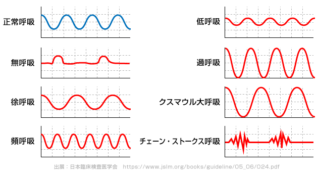 呼吸の種類と波形の図