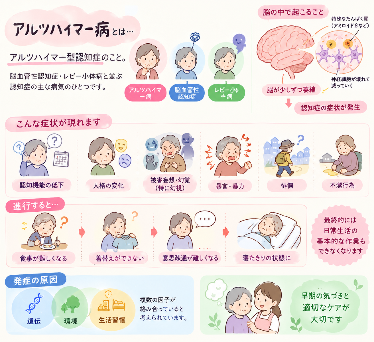 アルツハイマーとは？