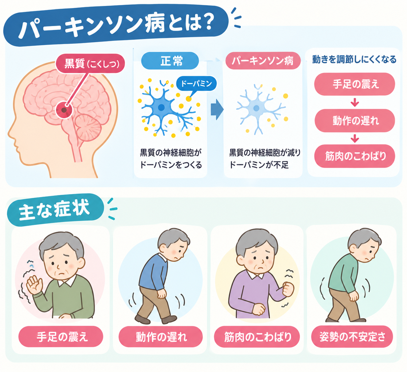パーキンソン病とは